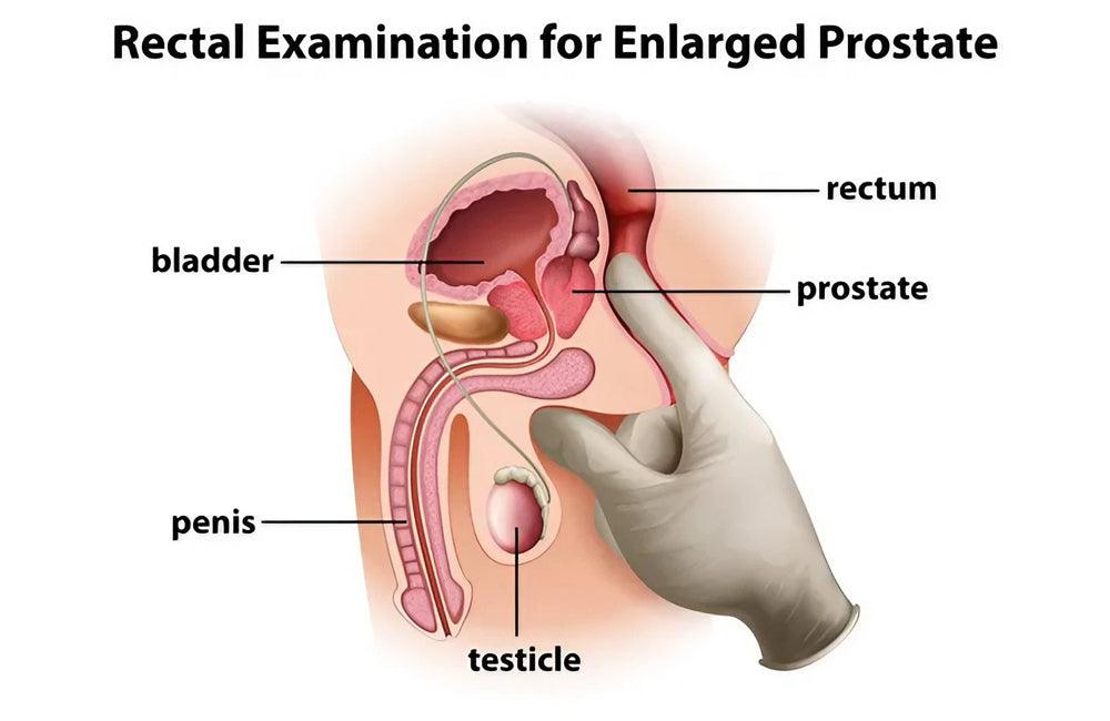 The Surprising Benefits of Prostate Massage: Exploring its Health and Pleasure Potential